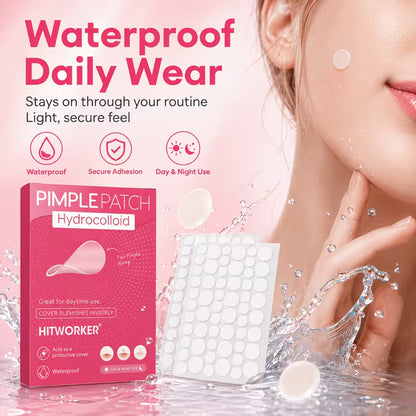 Aura Beauty SA™ Acne Patch Set (240 Patches)